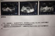 胎监检查报告怎么看男女