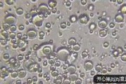揭秘！母乳放大倍后竟是活的！与配方奶的显微镜下大不同