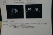 月经不规律与未孕状态原因、影响与应对策略