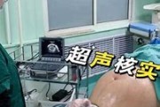 多少周臀位可以转为头位