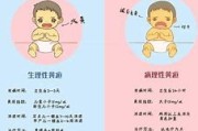 母乳性黄疸需要断奶吗?