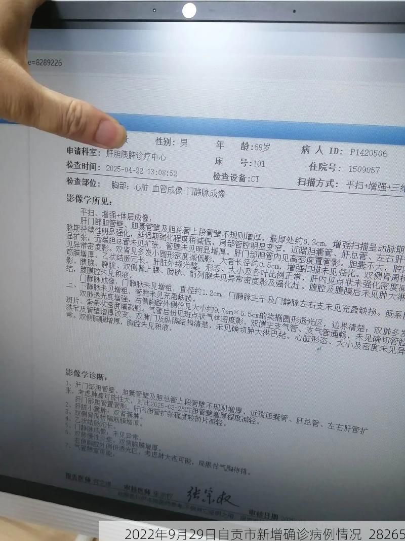 2022年9月29日自贡市新增确诊病例情况_28265