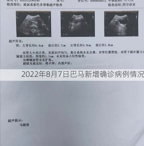 2022年8月7日巴马新增确诊病例情况