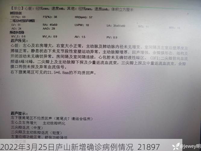 2022年3月25日庐山新增确诊病例情况_21897