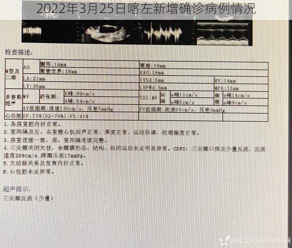 2022年3月25日喀左新增确诊病例情况