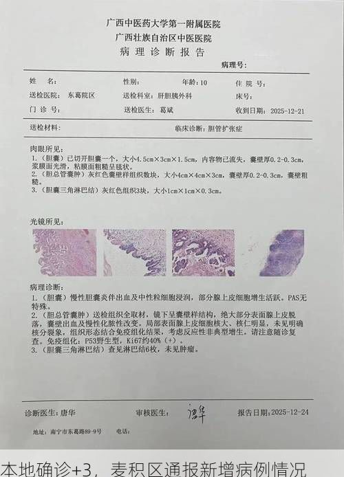 本地確診+3，麥積區(qū)通報(bào)新增病例情況