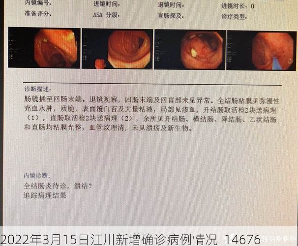 2022年3月15日江川新增确诊病例情况_14676