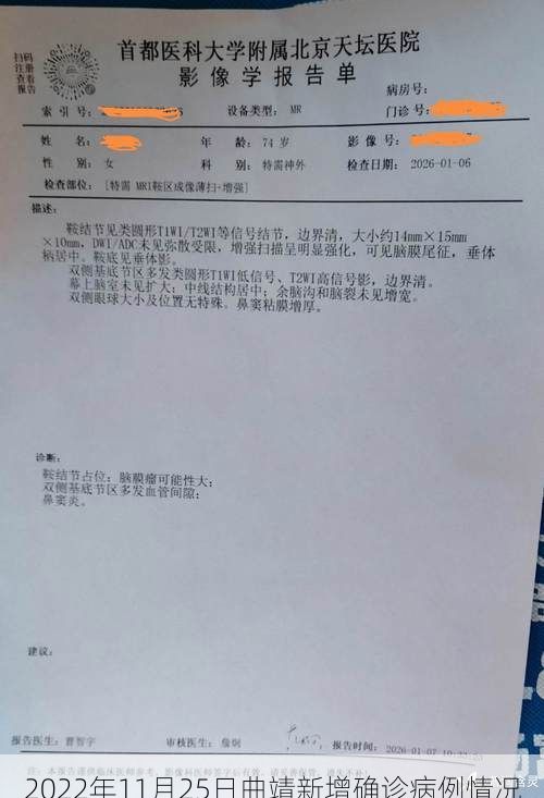 2022年11月25日曲靖新增确诊病例情况