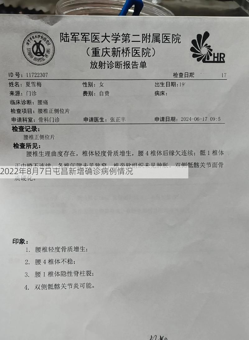 2022年8月7日屯昌新增确诊病例情况