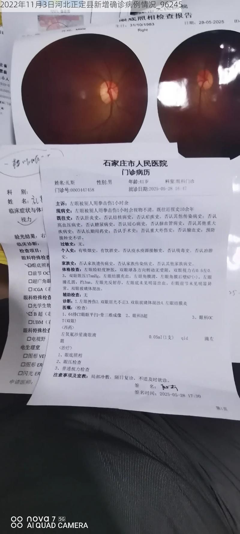 2022年11月3日河北正定县新增确诊病例情况_96245