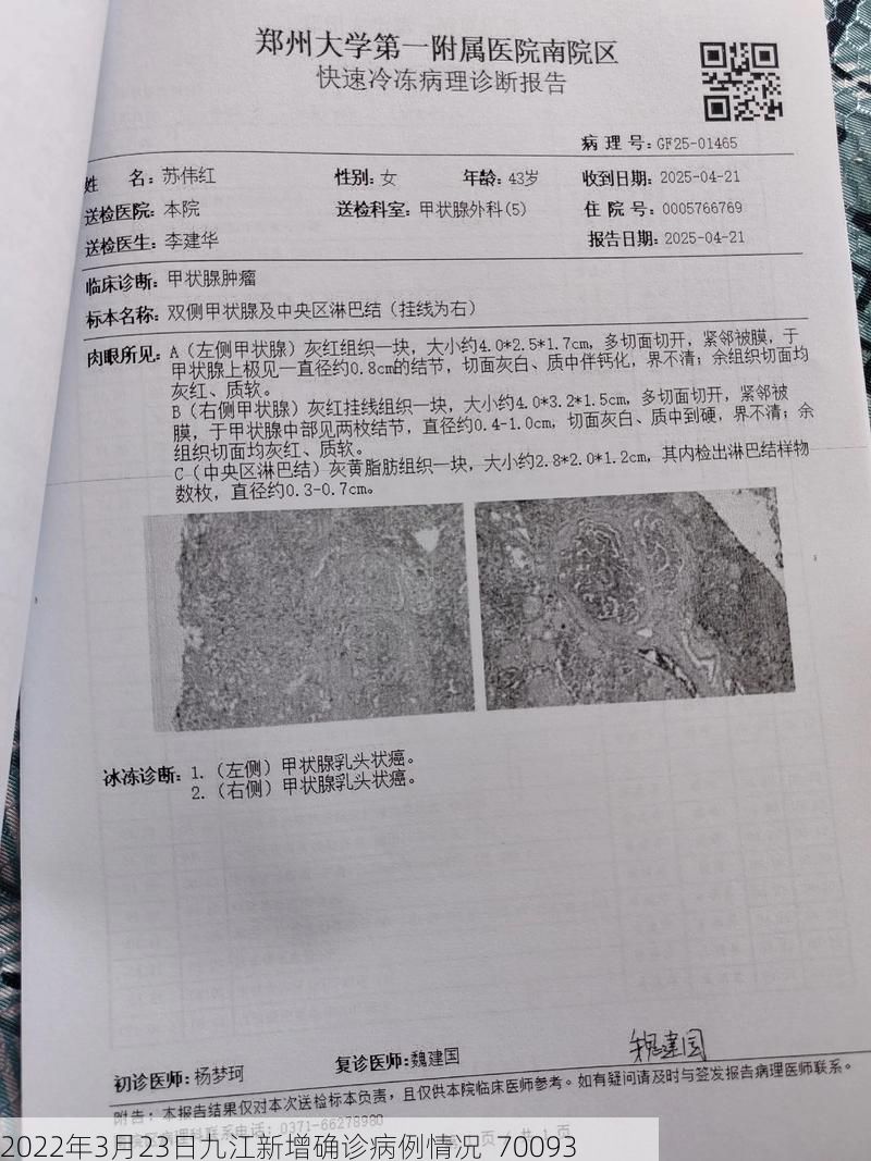 2022年3月23日九江新增确诊病例情况_70093