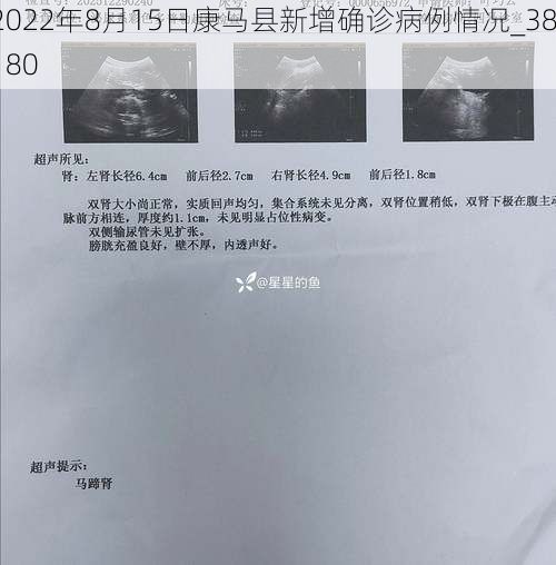 2022年8月15日康马县新增确诊病例情况_38180