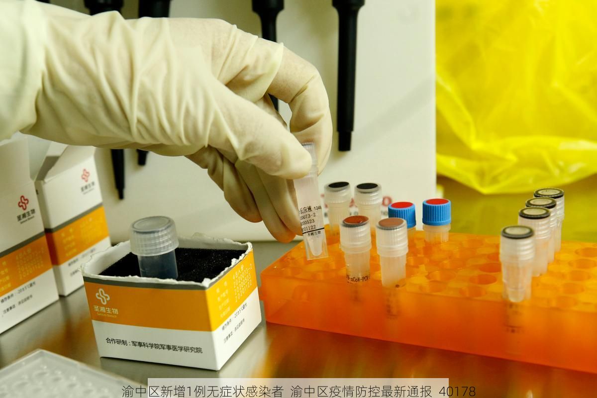 渝中區(qū)新增1例無癥狀感染者  渝中區(qū)疫情防控最新通報(bào)_40178