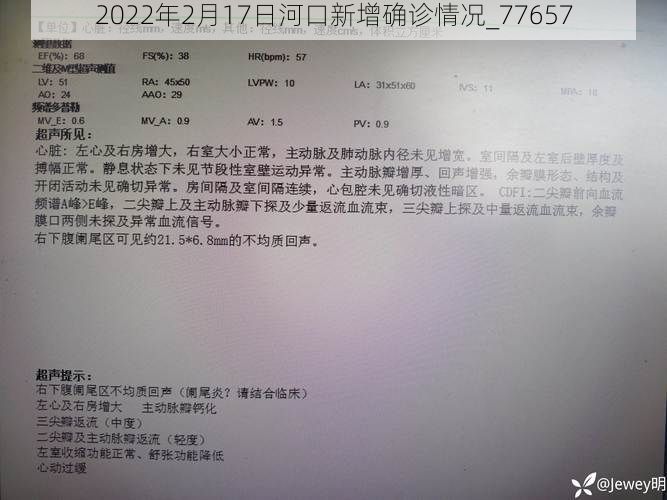 2022年2月17日河口新增确诊情况_77657