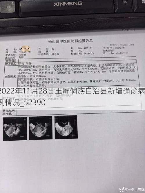 2022年11月28日玉屏侗族自治县新增确诊病例情况_52390