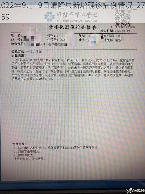2022年9月19日晴隆县新增确诊病例情况_27459
