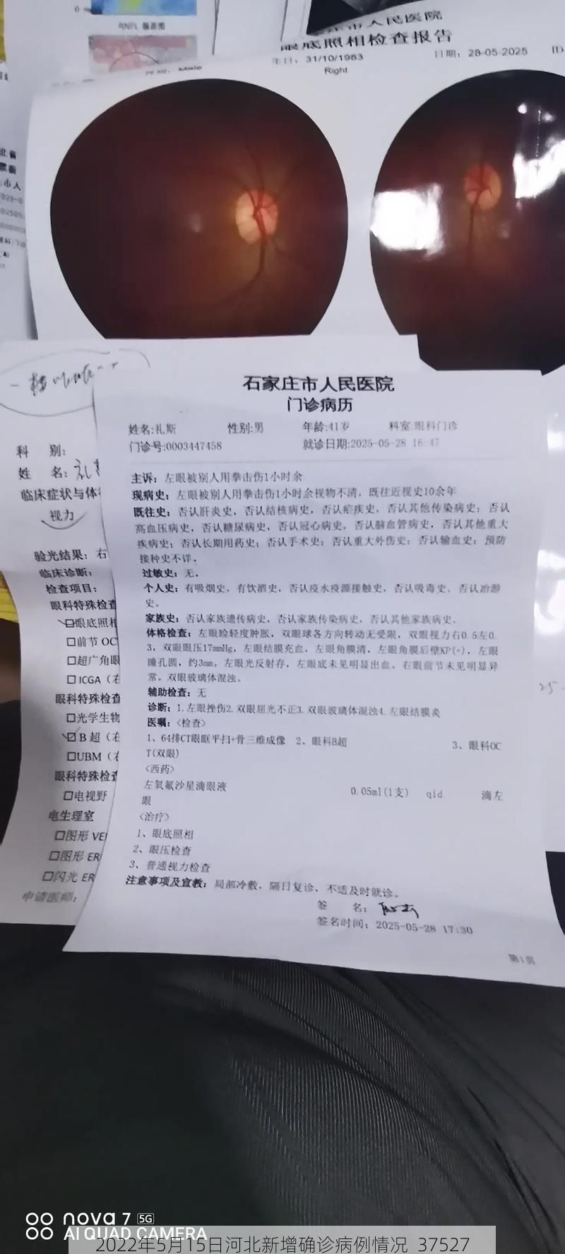 2022年5月15日河北新增确诊病例情况_37527