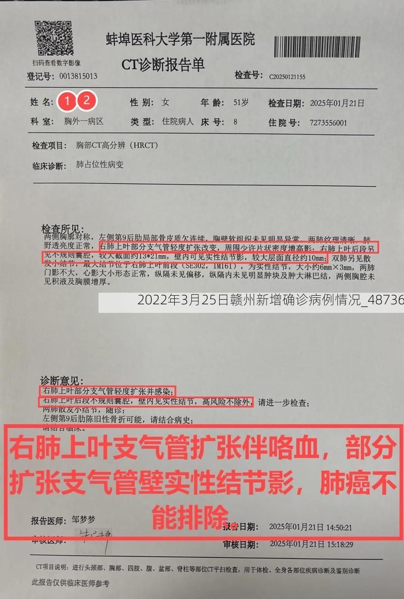 2022年3月25日赣州新增确诊病例情况_48736