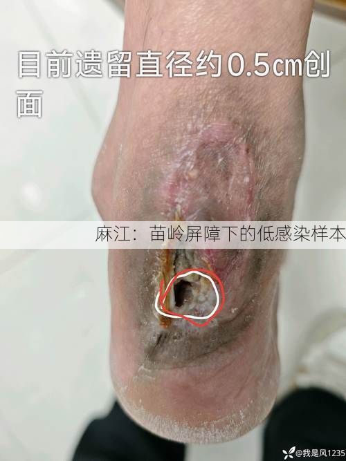 麻江:苗岭屏障下的低感染样本