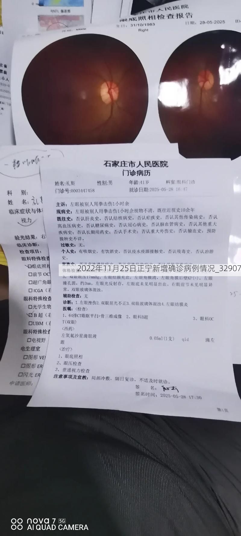 2022年11月25日正宁新增确诊病例情况_32907